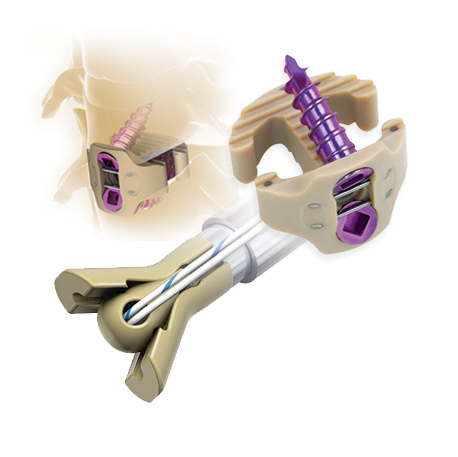 Latest Developments in PEEK® Component Cleaning.